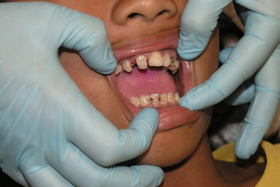 La santé dentaire: une importance capitale pour son bien-être buccal